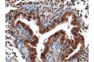 Image no. 4 for anti-5'-Nucleotidase Domain Containing 1 (NT5DC1) antibody (ABIN1499837)