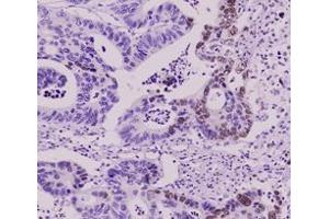 Immunohistochemistry (IHC) image for anti-Small Ubiquitin Related Modifier 2 (SUMO2) (AA 1-93), (N-Term) antibody (ABIN492386) (SUMO2 anticorps  (N-Term))