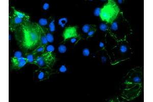 Anti-PDLIM2 mouse monoclonal antibody (ABIN2454449) immunofluorescent staining of COS7 cells transiently transfected by pCMV6-ENTRY PDLIM2 (RC210022). (PDLIM2 anticorps)