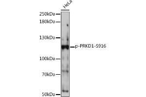 Western blot analysis of extracts of HeLa cells, using Phospho-PKC mu-S916 Rabbit pAb (ABIN7269642) at 1:1000 dilution.
