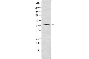 Western blot analysis of RMP using LOVO whole cell lysates (URI1 anticorps  (Internal Region))