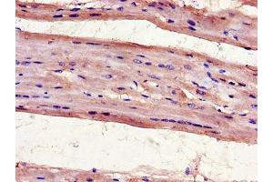 Immunohistochemistry of paraffin-embedded human heart tissue using ABIN7175097 at dilution of 1:100