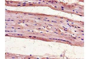 Immunohistochemistry of paraffin-embedded human heart tissue using ABIN7175097 at dilution of 1:100 (UNG anticorps  (AA 114-224))