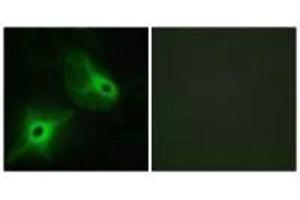 Immunofluorescence analysis of HeLa cells, using KSR2 antibody. (KSR2 anticorps)