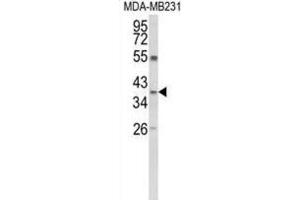 Western Blotting (WB) image for anti-Arginase, Liver (ARG1) antibody (ABIN5024445) (Liver Arginase anticorps)