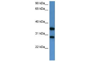 WB Suggested Anti-STYXL1 Antibody Titration: 0. (STYXL1 anticorps  (Middle Region))