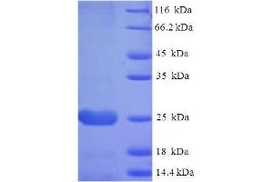 SDS-PAGE (SDS) image for Alveolar Soft Part Sarcoma Chromosome Region, Candidate 1 (ASPSCR1) (AA 23-214) protein (His tag) (ABIN5711213)