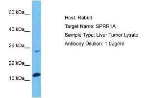 Host: Rabbit Target Name: SPRR1A Sample Tissue: Human Liver Tumor Antibody Dilution: 1ug/ml (SPRR1A anticorps  (Middle Region))