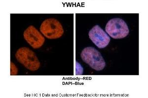 Sample Type :  Human brain stem cells  Primary Antibody Dilution :  1:500  Secondary Antibody :  Goat anti-rabbit Alexa-Fluor 594  Secondary Antibody Dilution :  1:1000  Color/Signal Descriptions :  Ywhae: Red DAPI:Blue  Gene Name :  Ywhae  Submitted by :  Dr. (YWHAE anticorps  (C-Term))