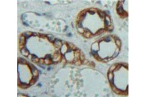 Used in DAB staining on fromalin fixed paraffin-embedded Kidney tissue