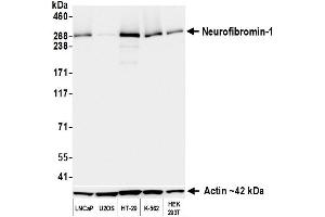 Western Blotting (WB) image for anti-Neurofibromin 1 (NF1) (C-Term) antibody (ABIN7795776)