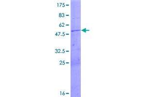 Image no. 1 for Mitochondrial Ribosomal Protein L24 (MRPL24) (AA 1-216) protein (GST tag) (ABIN1311310)