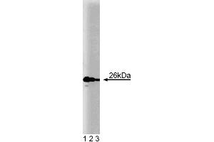 Western blot analysis of Bcl-2 (clone 7) on Jurkat cell lysate. (Bcl-2 anticorps  (AA 49-179))