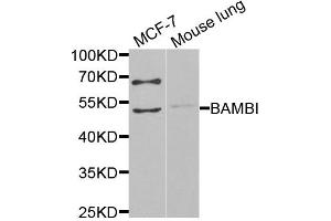 Western blot analysis of extracts of various cell lines, using BAMBI antibody (ABIN6291816) at 1:1000 dilution. (BAMBI anticorps)