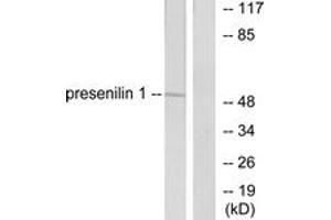 Western blot analysis of extracts from mouse heart cells, using Presenilin 1 Antibody. (Presenilin 1 anticorps  (AA 1-50))