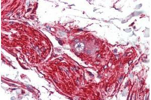 Human Nerve and Ganglion Cell (formalin-fixed, paraffin-embedded) stained with S100A10 antibody ABIN462133 followed by biotinylated anti-mouse IgG secondary antibody ABIN481714, alkaline phosphatase-streptavidin and chromogen. (S100A10 anticorps)