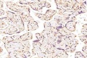 Immunohistochemistry analysis of paraffin-embedded human placenta using,SUN2 (ABIN7075502) at dilution of 1: 4000 (SUN2 anticorps)