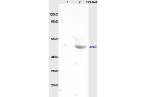 Lane 1: mouse brain lysates Lane 2: human colon carcinoma lysates probed with Anti HOXA10 Polyclonal Antibody, Unconjugated (ABIN741195) at 1:200 in 4 °C.