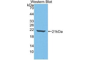 Western Blotting (WB) image for anti-Interleukin 18 Binding Protein (IL18BP) (AA 31-194) antibody (ABIN3201792) (IL18BP anticorps  (AA 31-194))