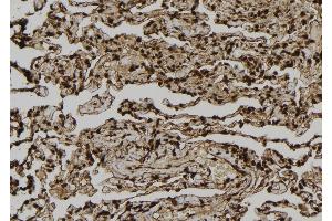ABIN6277015 at 1/100 staining Human lung tissue by IHC-P. (Dystonin anticorps  (C-Term))