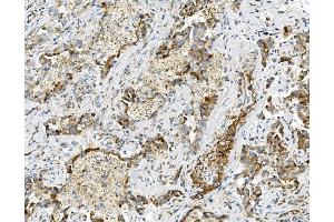 IHC analysis of USP16 using anti-USP16 antibody (ABIN7602640). (USP16 anticorps  (AA 9-823))
