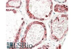ABIN870640 (5µg/ml) staining of paraffin embedded Human Thyroid Gland. (Thyroperoxidase anticorps  (Internal Region))