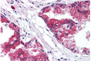 Human Prostate (formalin-fixed, paraffin-embedded) stained with TMED10 antibody ABIN214004 at 5 ug/ml followed by biotinylated goat anti-rabbit IgG secondary antibody ABIN481713, alkaline phosphatase-streptavidin and chromogen. (TMED10 anticorps  (Internal Region))