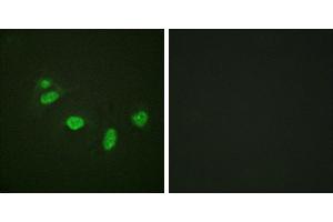 P-peptide - +Immunofluorescence analysis of HeLa cells, using ETS1 (Phospho-Thr38) antibody.