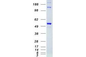 Validation with Western Blot