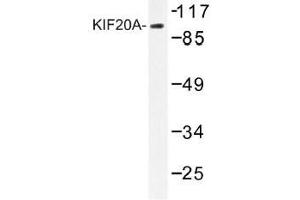 Image no. 1 for anti-Kinesin Family Member 20A (KIF20A) antibody (ABIN317796) (KIF20A anticorps)