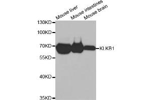 Western blot analysis of extracts of various cell lines, using KLKB1 antibody (ABIN2975433) at 1/1000 dilution. (KLKB1 anticorps)