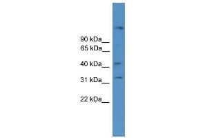 WB Suggested Anti-SYT11 Antibody Titration: 0. (SYT11 anticorps  (N-Term))