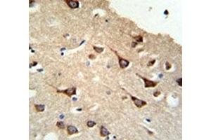 IHC analysis of FFPE human brain tissue stained with FYN antibody