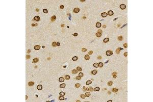 Immunohistochemistry of paraffin-embedded rat brain using Lamin A/C antibody.