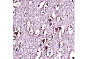 LMO2 antibody immunohistochemistry analysis in formalin fixed and paraffin embedded human brain tissue.
