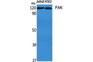 Western Blot (WB) analysis of specific cells using FAK Polyclonal Antibody. (FAK anticorps  (Thr435))