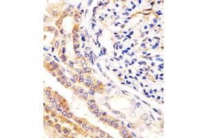 (ABIN388879 and ABIN2850431) staining USP2 in human kidney tissue sections by Immunohistochemistry (IHC-P - paraformaldehyde-fixed, paraffin-embedded sections). (USP2 anticorps  (C-Term))