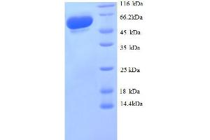 Glyceraldehyde-3-Phosphate Dehydrogenase (GAPDH) (AA 3-335), (partial) protein (GST tag)