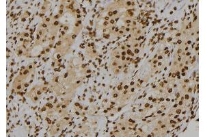 ABIN6277118 at 1/100 staining Human kidney tissue by IHC-P.