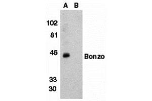 Western Blotting (WB) image for anti-Chemokine (C-X-C Motif) Receptor 6 (CXCR6) (N-Term) antibody (ABIN1031691) (CXCR6 anticorps  (N-Term))