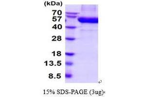 SDS-PAGE (SDS) image for Discoidin Domain Receptor tyrosine Kinase 2 (DDR2) (AA 22-399) protein (His tag) (ABIN5854620)