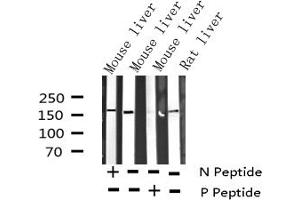 Western blot analysis of Phospho-EGFR (Thr693) expression in various lysates (EGFR anticorps  (pThr693))