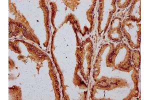 IHC image of ABIN7149497 diluted at 1:400 and staining in paraffin-embedded human prostate tissue performed on a Leica BondTM system. (DAZAP2 anticorps  (AA 1-168))