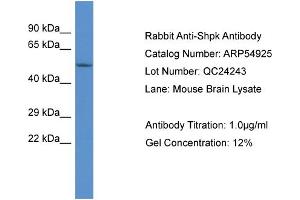 Western Blotting (WB) image for anti-Sedoheptulokinase (SHPK) (Middle Region) antibody (ABIN2785956) (SHPK anticorps  (Middle Region))