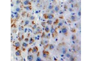 IHC-P analysis of Liver tissue, with DAB staining. (OLR1 anticorps  (AA 81-273))