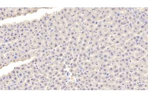 Detection of FABP1 in Rat Liver Tissue using Polyclonal Antibody to Fatty Acid Binding Protein 1 (FABP1)