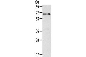 Gel: 8 % SDS-PAGE,Lysate: 40 μg,Primary antibody: ABIN7131054(SIGLEC12 Antibody) at dilution 1/500 dilution,Secondary antibody: Goat anti rabbit IgG at 1/8000 dilution,Exposure time: 1 minute (SIGLEC12 anticorps)