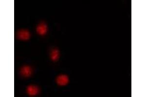 ABIN6267249 staining HT29 by IF/ICC.