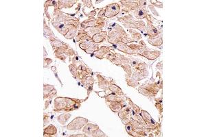 Immunohistochemical analysis of paraffin-embedded H. (SGCG anticorps  (AA 145-172))