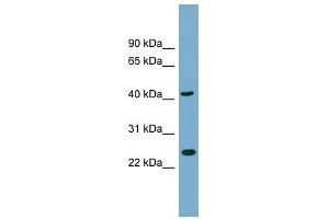 FLJ25439 antibody used at 1 ug/ml to detect target protein. (TTC23L anticorps  (N-Term))